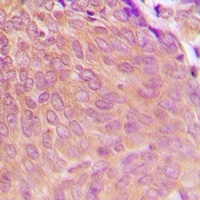 PPP2CA Antibody