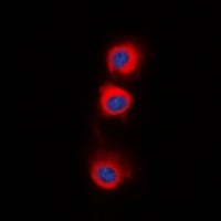 PPP2CA Antibody