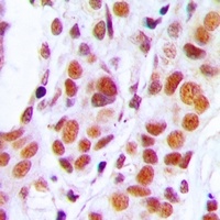 Anti-RB1 Antibody