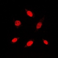 Anti-RB1 Antibody