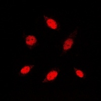 RB1 antibody