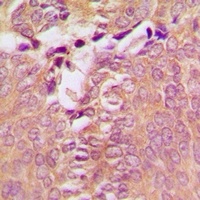 Anti-DAP Kinase 1 Antibody
