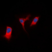 Anti-DAP Kinase 1 Antibody