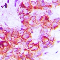 HER2 Rabbit Polyclonal Antibody