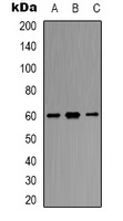 SMAD2 Rabbit Polyclonal Antibody