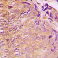 Anti-GRB10 Antibody