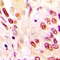 hNRNP C antibody