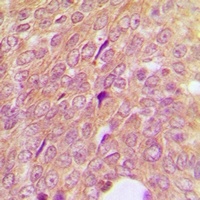 Anti-IGFBP3 Antibody