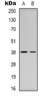 Nucleophosmin Rabbit Polyclonal Antibody