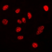 Nucleophosmin Rabbit Polyclonal Antibody