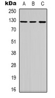 Telomerase Rabbit Polyclonal Antibody
