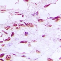 Anti-DNA Ligase 4 Antibody