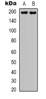 Topoisomerase 2 alpha Rabbit Polyclonal Antibody