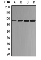 Beta-catenin Rabbit Polyclonal Antibody