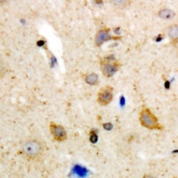 Anti-BLK Antibody