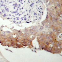 Anti-cGK 2 Antibody