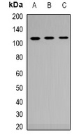 Androgen Receptor Rabbit Polyclonal Antibody