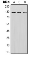 SREBP1 Rabbit Polyclonal Antibody