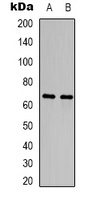 CRMP2 Rabbit Polyclonal Antibody