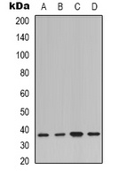 IKB alpha Rabbit Polyclonal Antibody