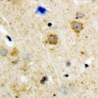 Anti-GRK3 Antibody