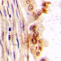 Anti-hnRNP M Antibody