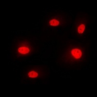 Anti-hnRNP M Antibody