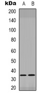 PITX1 Antibody