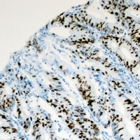Anti-PITX1 Antibody