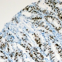 PITX1 antibody