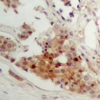 Anti-CAR Antibody