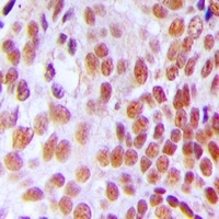 Anti-GTF3C2 Antibody