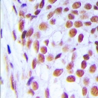 DNA Ligase 1 antibody