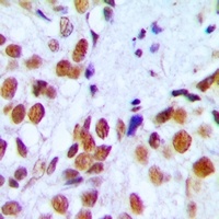 Anti-RAD54A Antibody