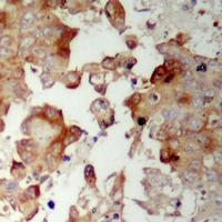 Anti-MRPS17 Antibody
