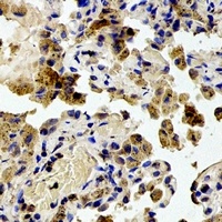 Anti-RPS20 Antibody