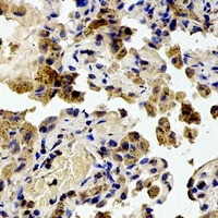 RPS20 antibody