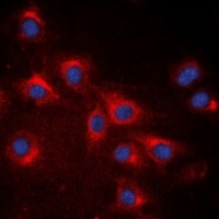 Anti-RPS20 Antibody