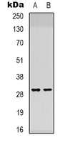 ATP5F1 Rabbit Polyclonal Antibody