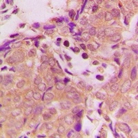 B3GALTL antibody