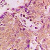 Anti-B3GALTL Antibody