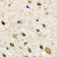 Anti-CSGALNACT2 Antibody