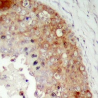 Anti-LRRC41 Antibody