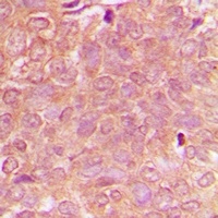 Anti-NBEAL1 Antibody