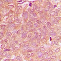 NBEAL1 antibody