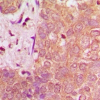 Anti-NAV1 Antibody