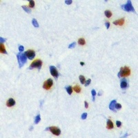 Anti-NOL8 Antibody