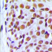 PRPF6 antibody