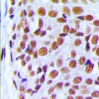 Anti-PRPF6 Antibody
