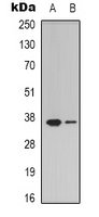 ZDHHC20 Antibody